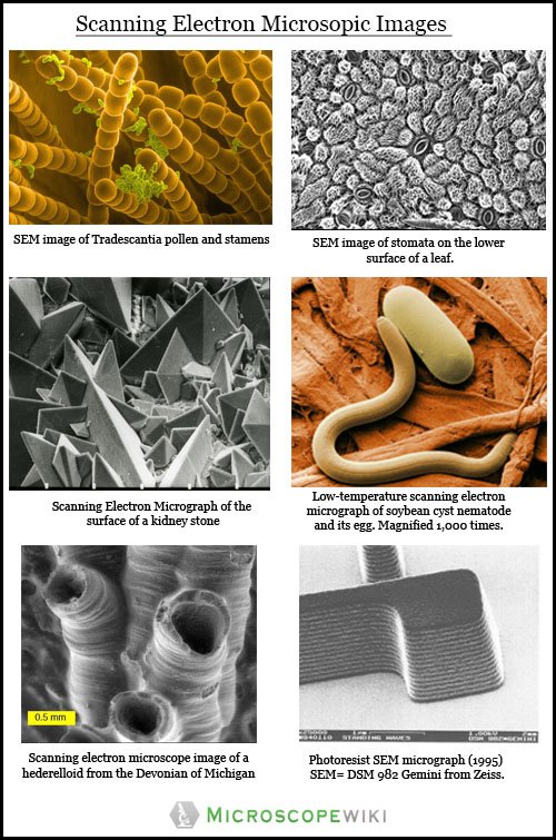 different organism metals kidney stone images under scanning electron microscope sem