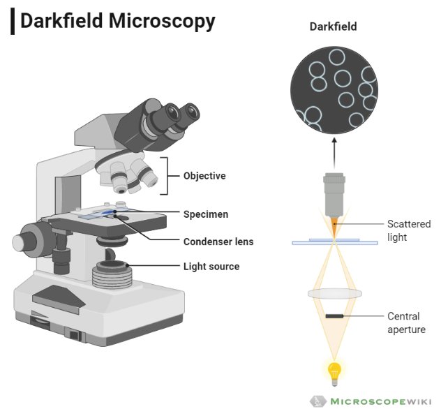 Dark field microscope diagram image (picture)